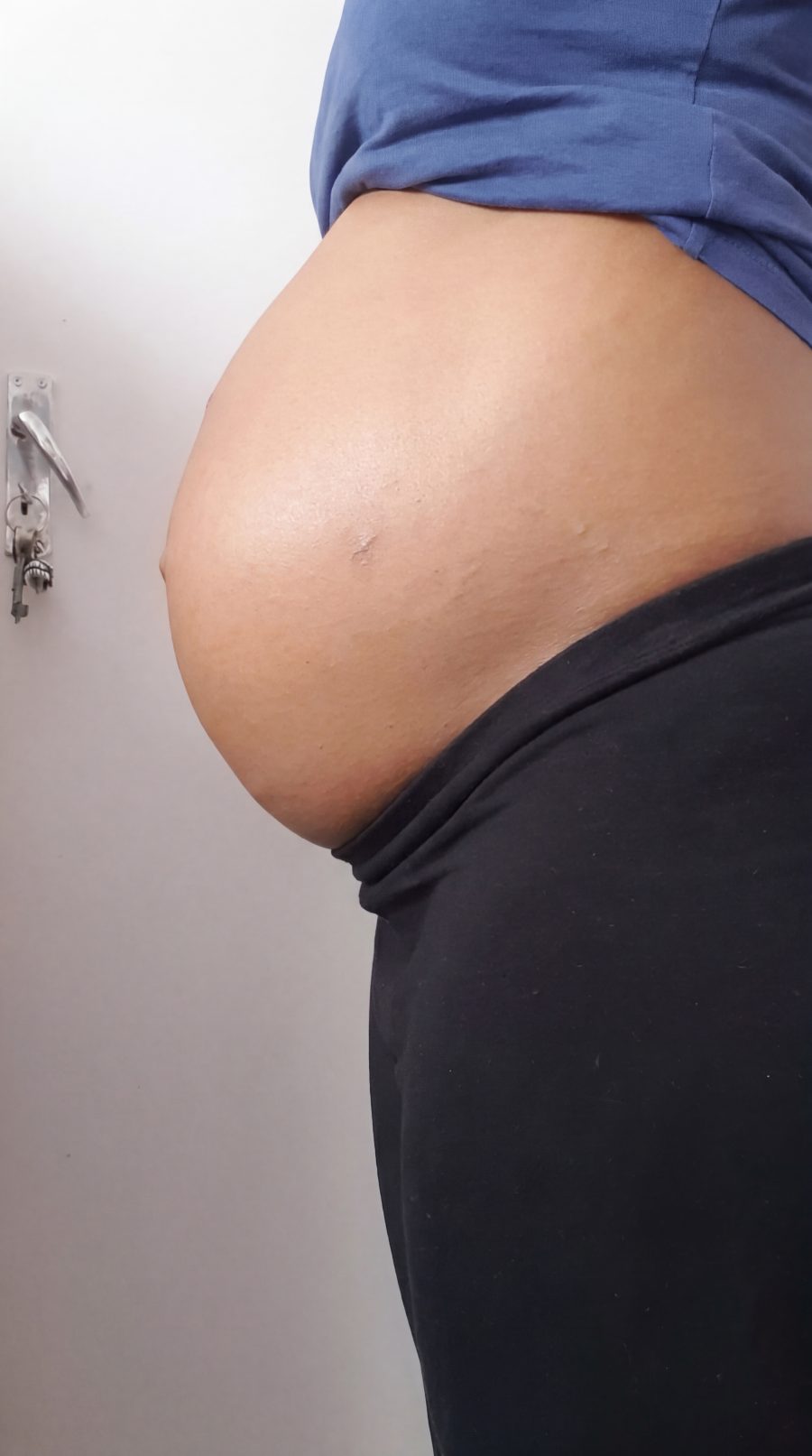 Side profile photo of a large fibroid belly, often mistaken for a pregnancy bump