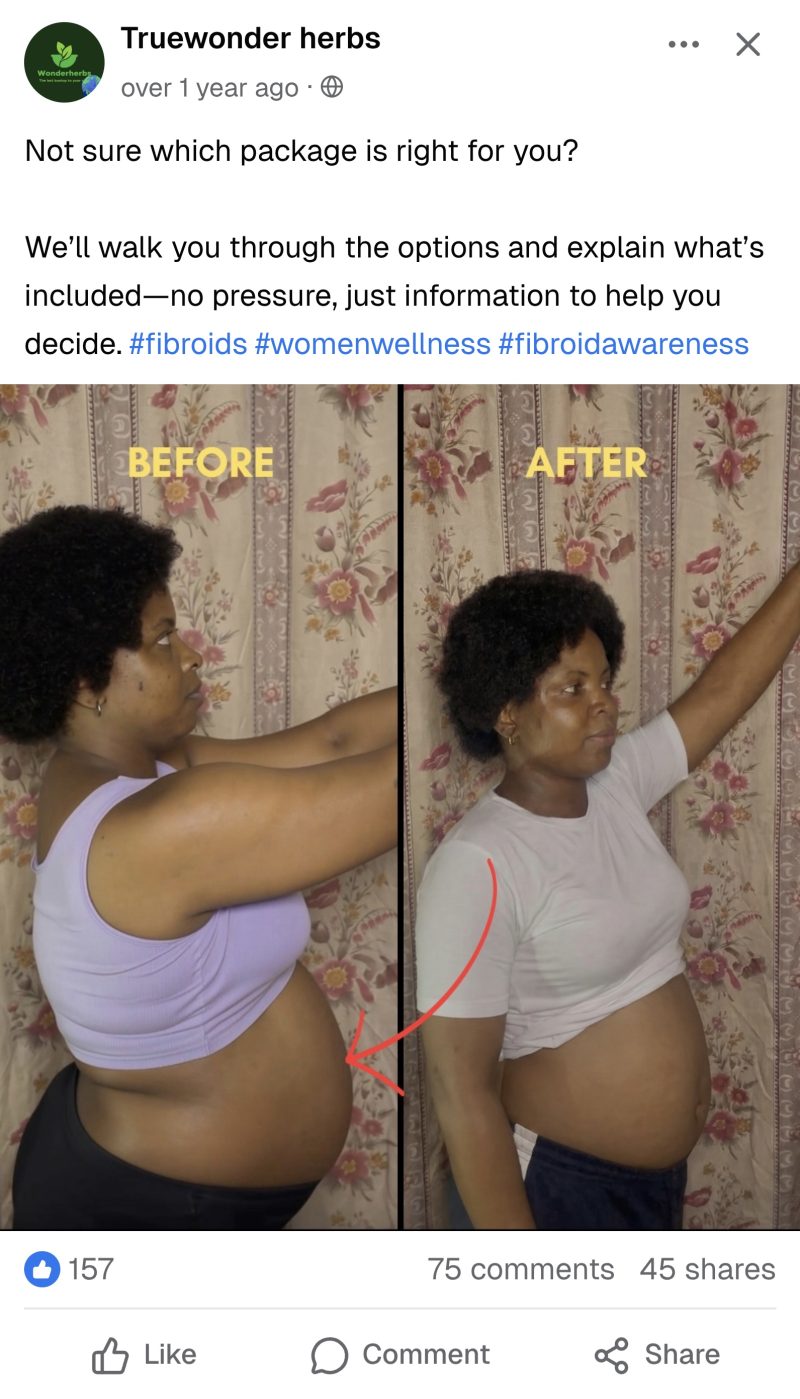 Facebook post showing a before and after fibroid belly comparison